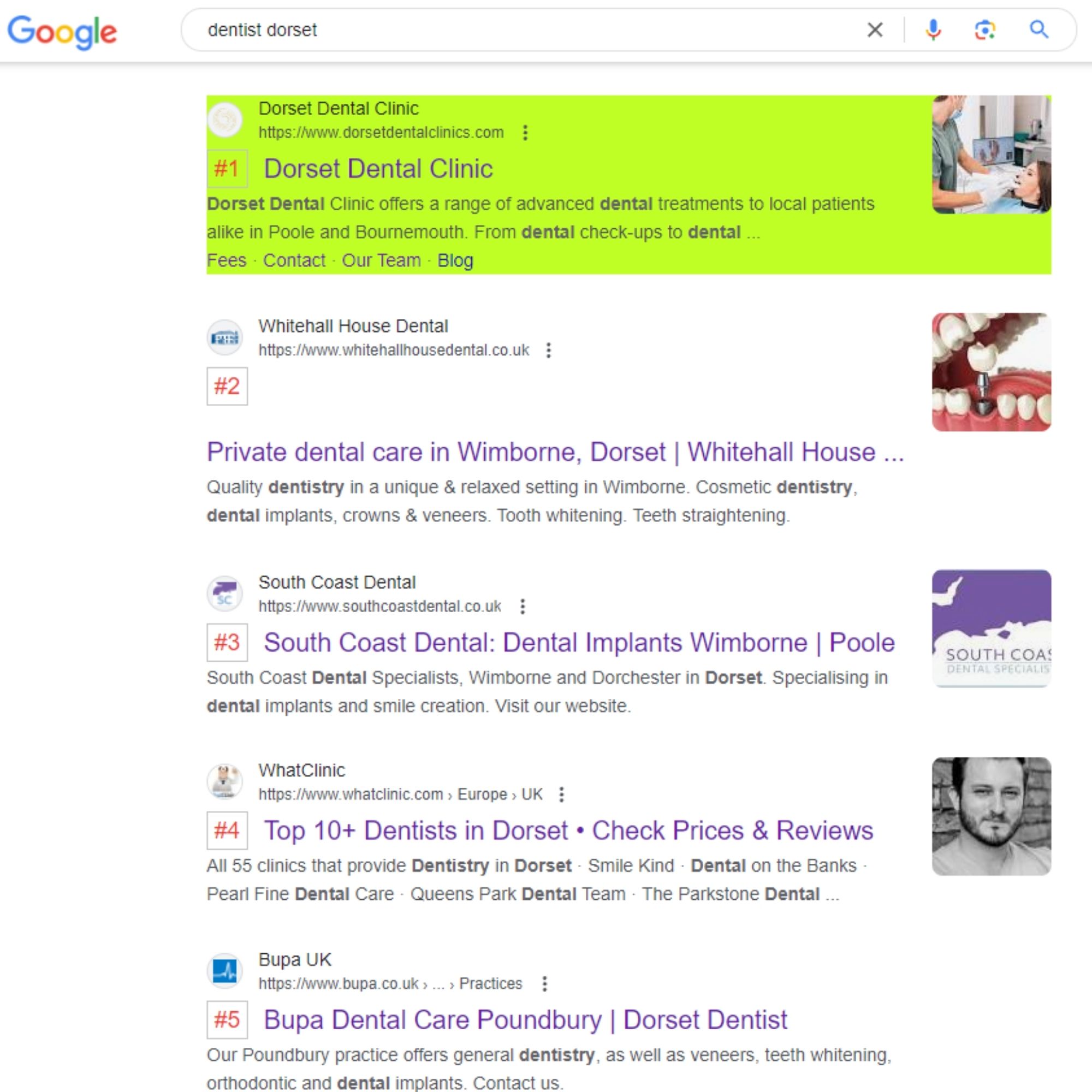 seo result for dentist in dorset